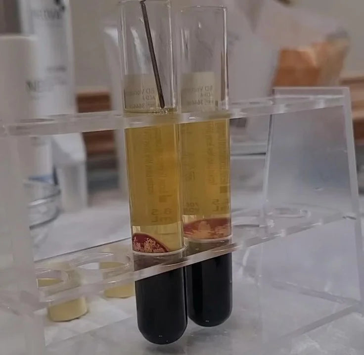 image depicting platelet rich plasma (prp) in test tube vials ready for treatment at privi studios